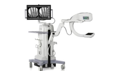OEC MiniView