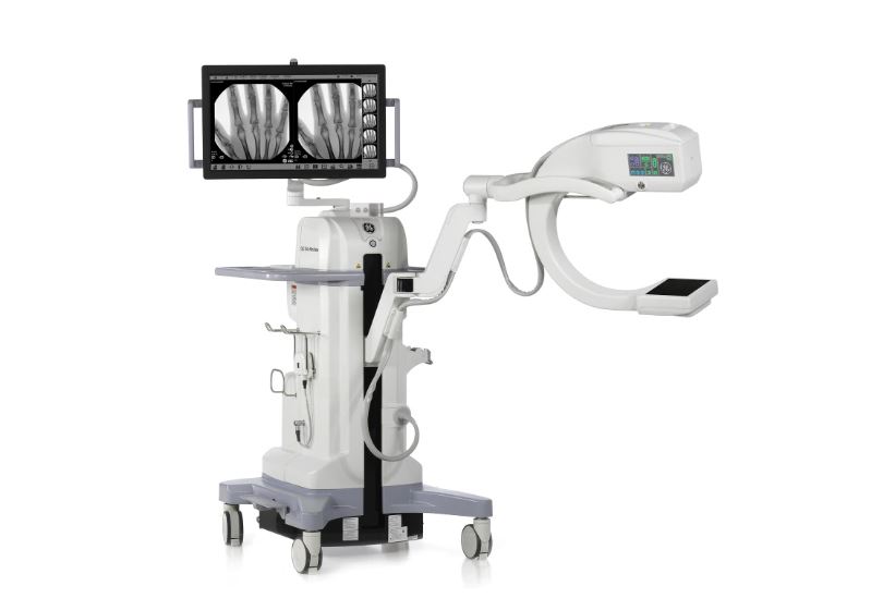 OEC MiniView