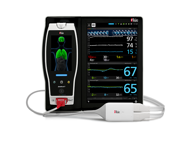 Root with O3 Regional Oximetry