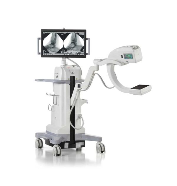 OEC MiniView Max