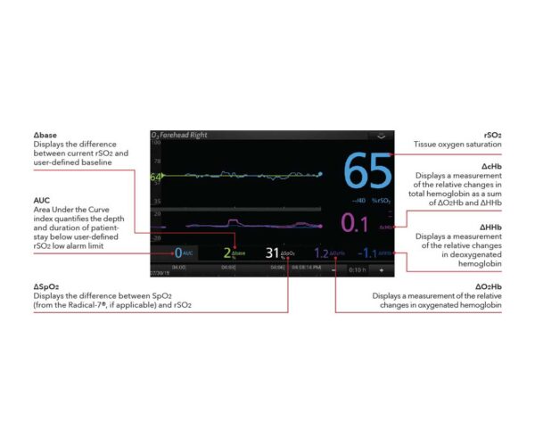 Root with O3 regional Oximetry - Image 2